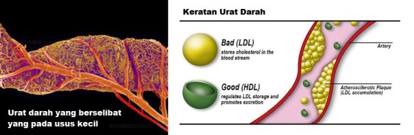 urat darah 1